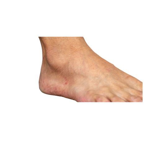 ankle